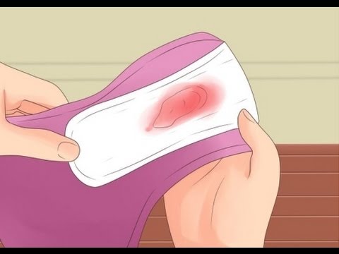 Vídeo: Sangrado Vaginal Entre Períodos: Causas, Prevención Y Diagnóstico