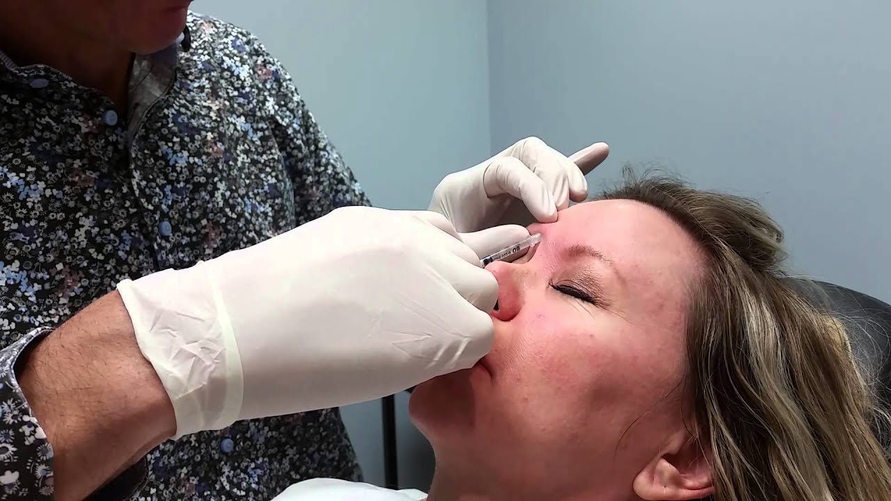 Dysport for Wrinkles made Easy, Dr Weiner