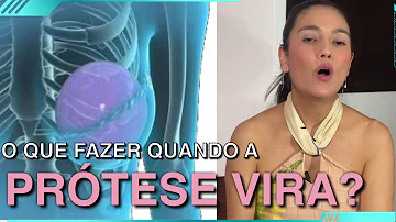 Quanto tempo leva para a prótese encaixar?