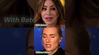 Sofía Vergara vs Kate Winslet: Facial Movement, Lines &amp; Personal Choice