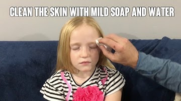 How to Use Eye Patch to Treat Lazy Eye on Kids | Opthopatch Eye Patches with Cool Kids Design