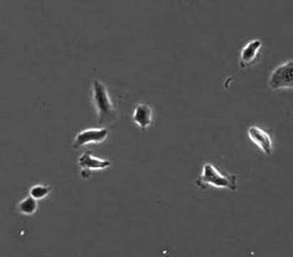 NKI: huidcellen van de muis met een uitgeschakeld Tiam1