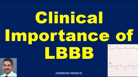 Atrial fibrillation with left bundle branch block treatment