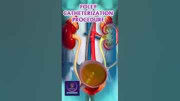 Foley Catheterization Animation - Urine Drainage Process