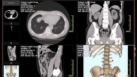 fpGui based Dicom Viewer