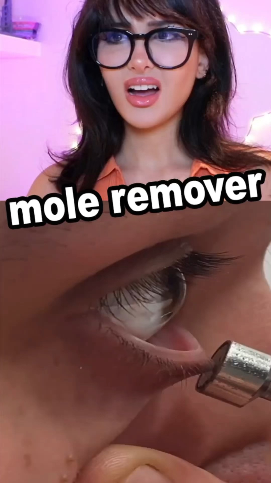 This Device Removes Moles!?