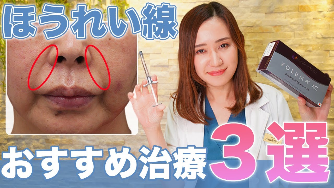 【ほうれい線】美容皮膚科医がオススメする治療法3選を紹介します！