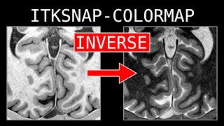Tutorial - Inverse grayscale in ITKSNAP