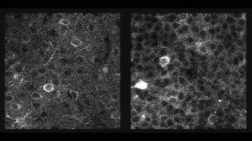 Calcium Activity in Mice Brain