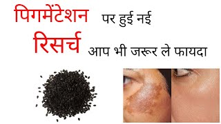 NEW RESEARCH ABOUT PIGMENTATION, by Dr. Manoj Das