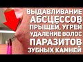 КАРАВАЙTV / ВЫДАВЛИВАНИЕ АБСЦЕССОВ, ПРЫЩЕЙ, УГРЕЙ / УДАЛЕНИЕ ВРОСШИХ ВОЛОС, ПАРАЗИТОВ, ЗУБНЫХ КАМНЕЙ