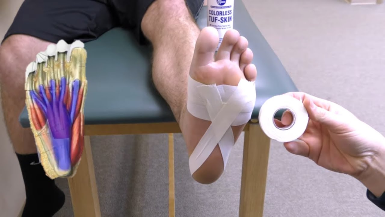 Teardrop Arch Taping for Plantar Fasciitis YouTube