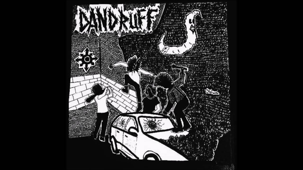 Watch DANDRUFF INTRO on YouTube Watch DANDRUFF INTRO on YouTube