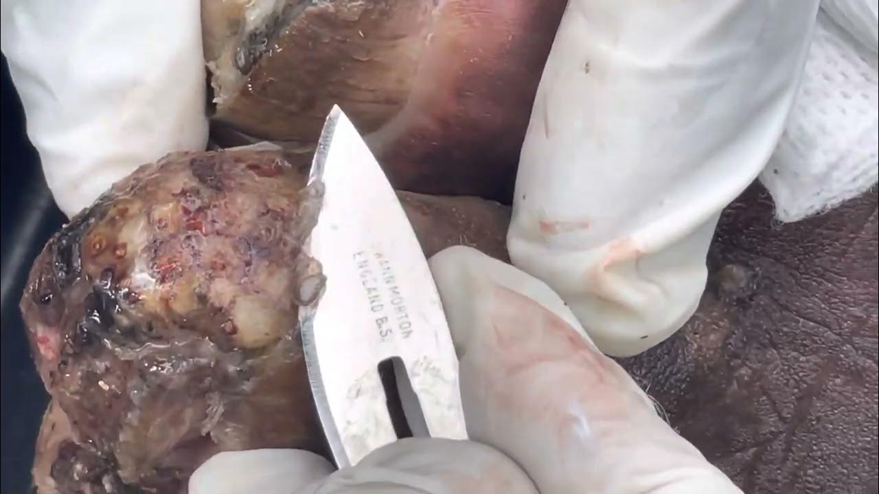 James's feet packed with jigger clusters watch full video and others