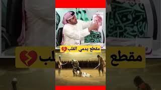 كيف ذبـح شمر بن ذو الجوشن الامام الحسيـن عليه السلام|مقطع يدمي القلوب|#تلسكوب_رافضي