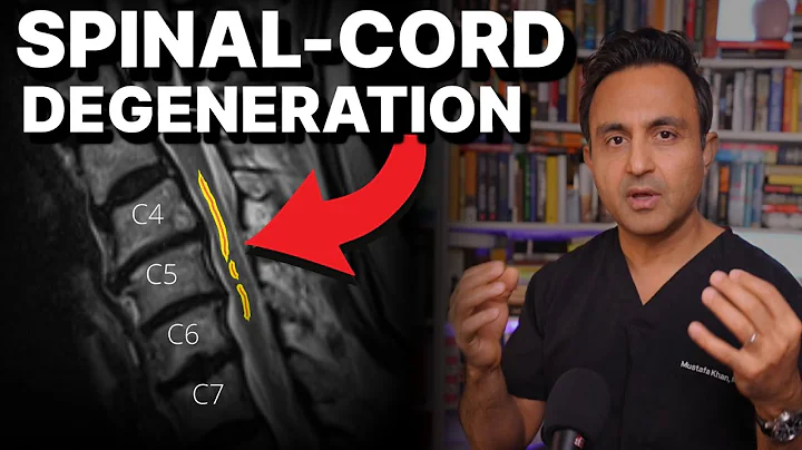 Spinal cord degeneration (myelomalacia) surgical treatment