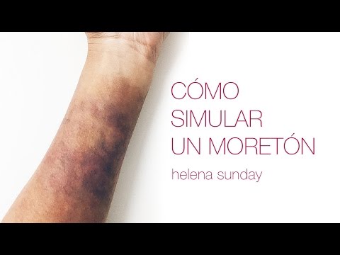 Video: Cómo Dibujar Un Hematoma