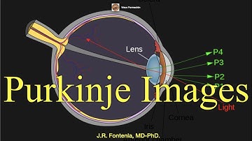 Purkinje Images. Purkinje-Sanson images.