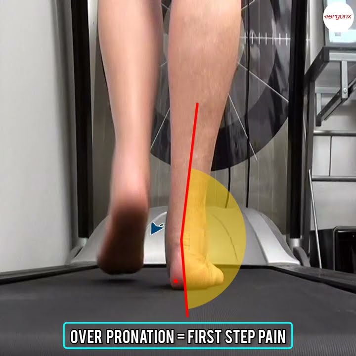 First Step Pain First Step Pain can be related to plantar fasciitis and lack of foot ...