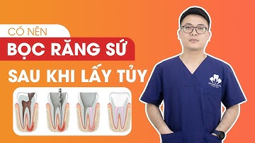 Có nên bọc răng sứ sau khi lấy tủy răng | Nha Khoa Dr. Hưng
