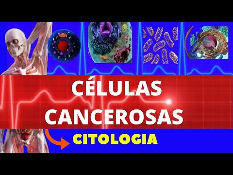 Vídeo: As células cancerosas são diferenciadas ou indiferenciadas?