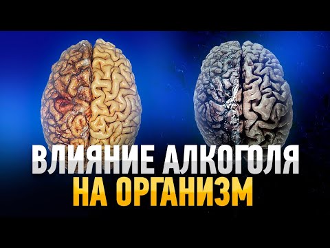 Влияние Алкоголя на Организм (РЕАЛЬНЫЕ ФАКТЫ)