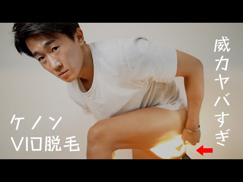 本気】ケノンでVIO脱毛！その効果と安全で効率的な使い方とは？ - YouTube