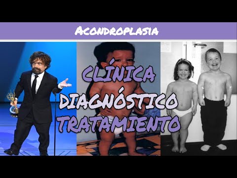 ⚕️🩺 ACONDROPLASIA: Genética, Síntomas, Diagnóstico y Tratamiento