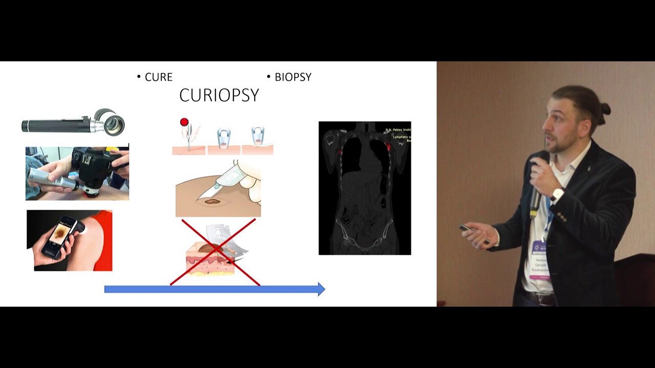 Эксцизионная биопсия против широкого иссечения - почему в эру ранней ...