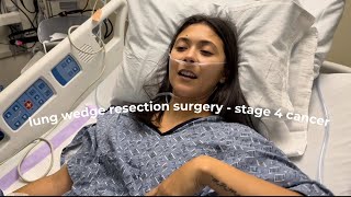 my lung wedge resection - stage 4 colorectal cancer | lung metastasis 