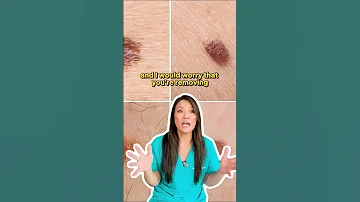 Have You Tried To Remove A Skin Tag Yourself And How Did It Work Out For You 