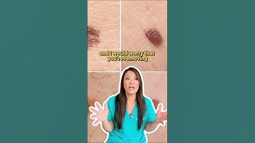 Have you tried to remove a skin tag yourself and how did it work out for you?⁠