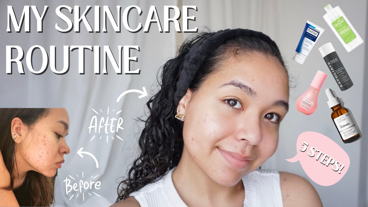 How I Do My Skincare Routine in Only FIVE Steps! for Dry Combination ...