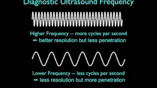 Ultrasound Physics Basics Physics and Image Generation