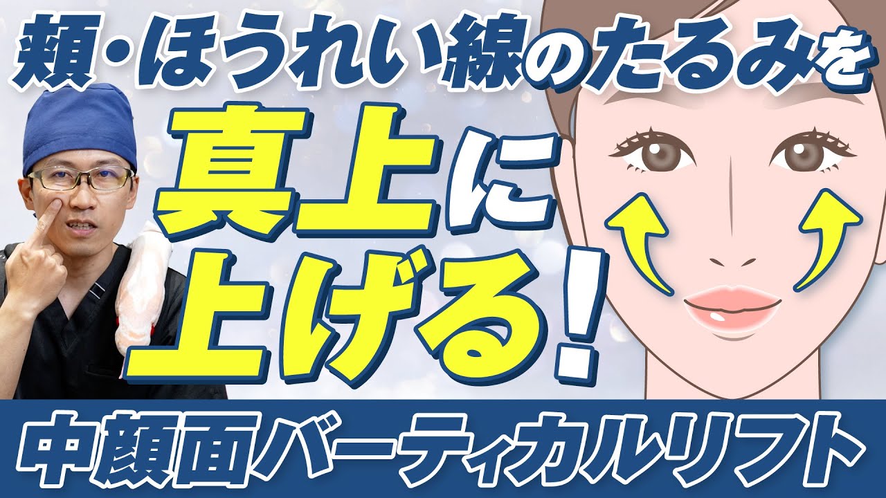 ほうれい線の消し方｜原因・セルフケア・おすすめの美容医療を徹底解説