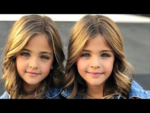 видео: В 2017 году их называли самыми красивыми близняшками! Посмотрите какие они сейчас!
