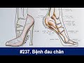 # 237. Bệnh đau nhức bàn chân và cổ chân