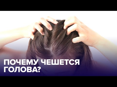 Почему ЧЕШЕТСЯ ГОЛОВА и как избавиться от ЗУДА?