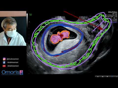 Vídeo: Como ler uma imagem de ultrassom: 9 etapas (com imagens)