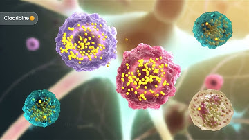 MAVENCLAD® (cladribine) Proposed Mechanism of Action for Multiple Sclerosis