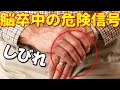 脳卒中の前兆とは！？脳梗塞の危険信号｢しびれ｣に注意！危険に備えるために…