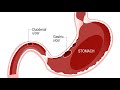 Pathophysiology of peptic ulcerpathophysiology of duodenal ulcer bsc nursing 3rd semester steps