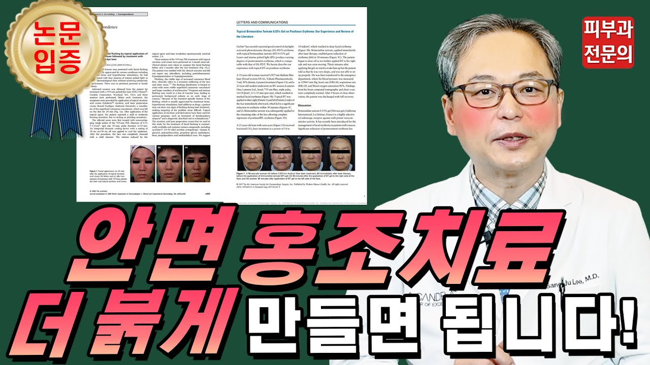 세계적 학회에 소개한 😡 안면홍조 없애는법 😡 공개 (Feat. 홍반유도프리마) - YouTube