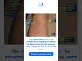 Spotter of the Day | Median Cubital Vein & Venipuncture Anatomy | MBBS Anatomy