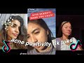 ACNE POSITIVITY TIKTOK COMPILATION | BODY POSITIVITY TIKTOK COMPILATION