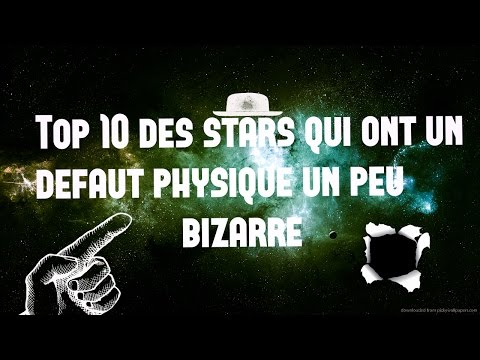 Vidéo: De jolis défauts : 5 célébrités avec des défauts physiques