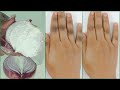 Just 2 Ingredients Can Effectively Clear Dark Knuckles, Elbows And Knees