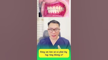 Lưu ý với khớp cắn ngược khi đi làm răng sứ