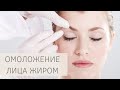 ЛИПОФИЛИНГ ЛИЦА | Омоложение ЖИРОМ