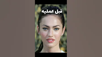 أفشل عمليات التجميل راح تنصدمون من الأشكال 